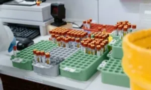 Lo ngại về vụ thất lạc 300 lọ chứa virus nguy hiểm ở Australia